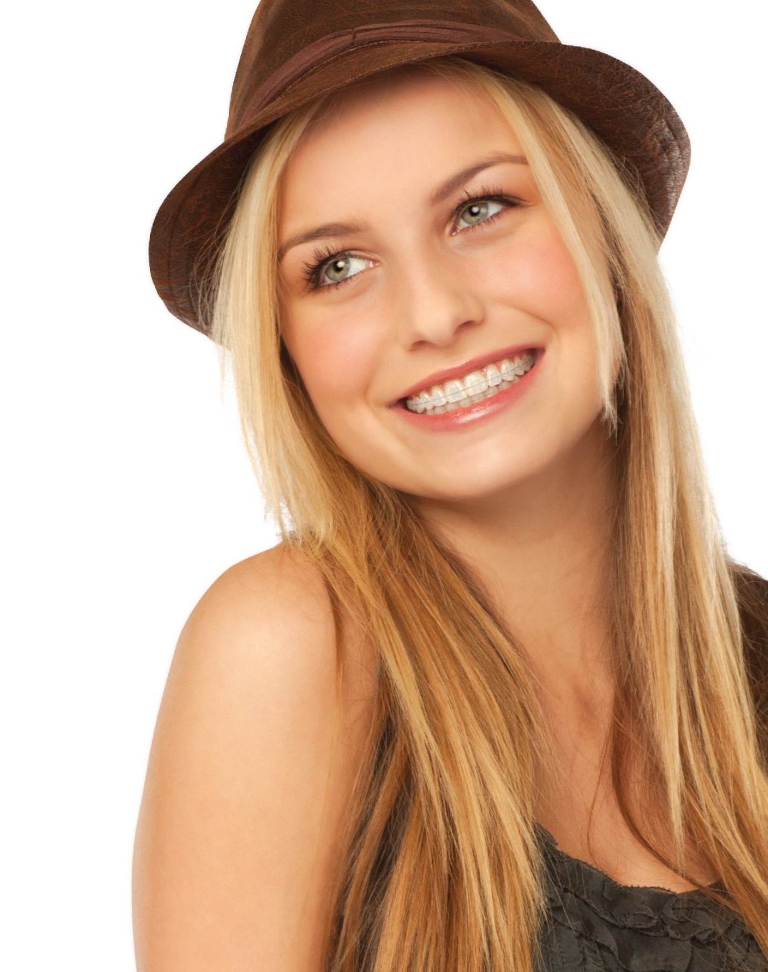 Clarity™ Braces Payne Orthodontics