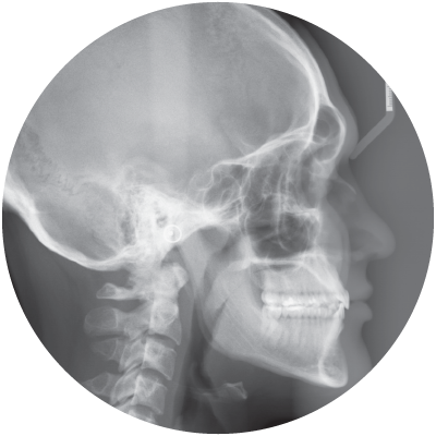 Cephalometric X-ray